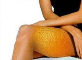 Мифы о целлюлите