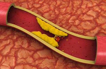 Статья: Что нужно знать о холестерине